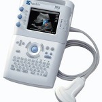 Sonosite-180-Plus.jpg