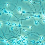 Sperm under a microscope