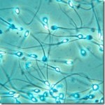 human-sperm_thumb.jpg